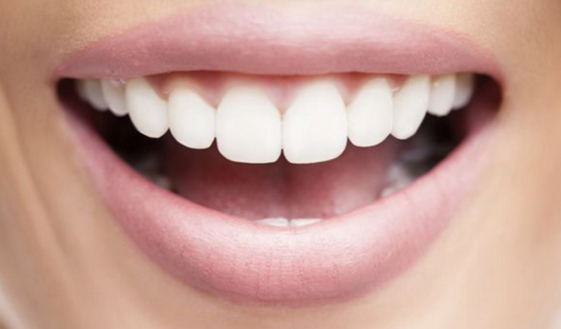 OKC Dentist Damon R. Johnson, DDS Describes Cosmetic Dentistry Options